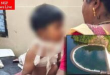 इटियाडोह धरणावर दुर्दैवी घटना : बिबट्याच्या हल्ल्यात ४ वर्षीय बालक गंभीर जखमी